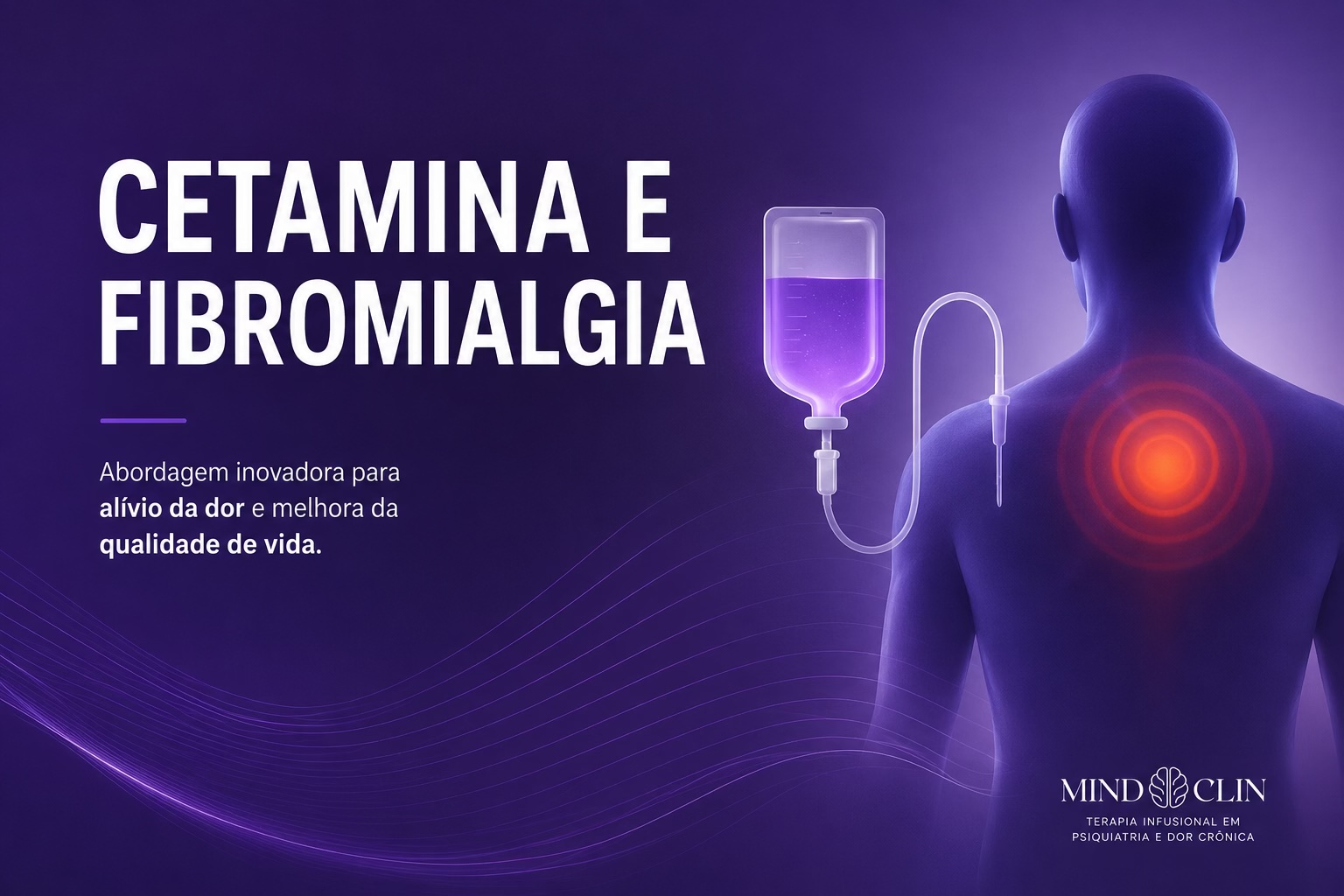 Bloqueio Simpático Venoso com cetamina
